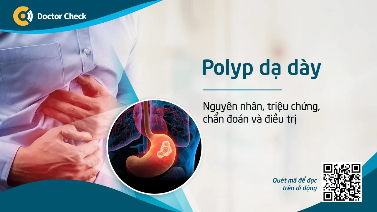 Polyp dạ dày: Nguyên nhân, triệu chứng, chẩn đoán và điều trị
