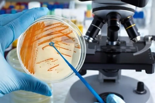 Cấy phân là xét nghiệm nuôi cấy mẫu phân được lựa chọn để chẩn đoán nhiễm trùng đường tiêu hóa do vi khuẩn. (Ảnh minh họa sưu tầm)