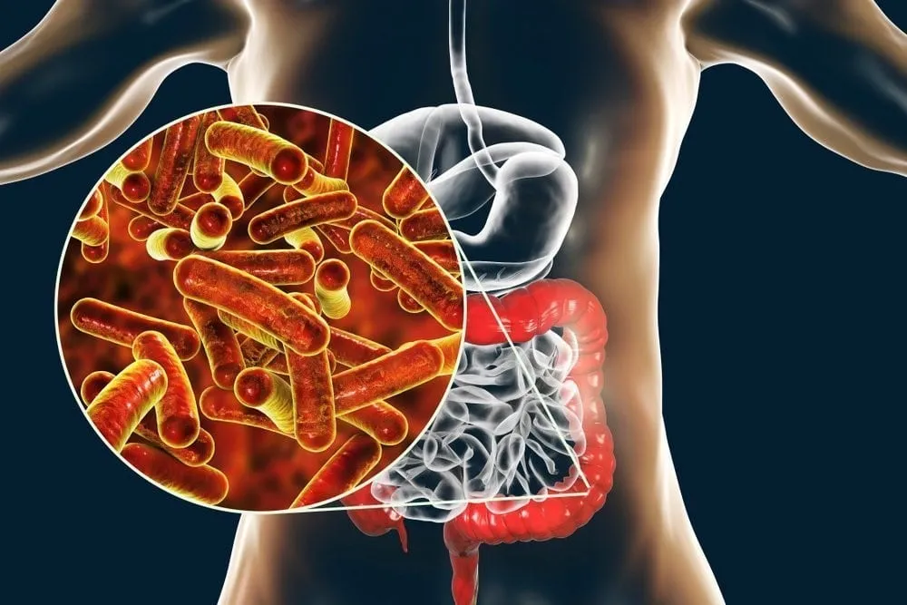 Bệnh viêm ruột do ký sinh trùng là gì?