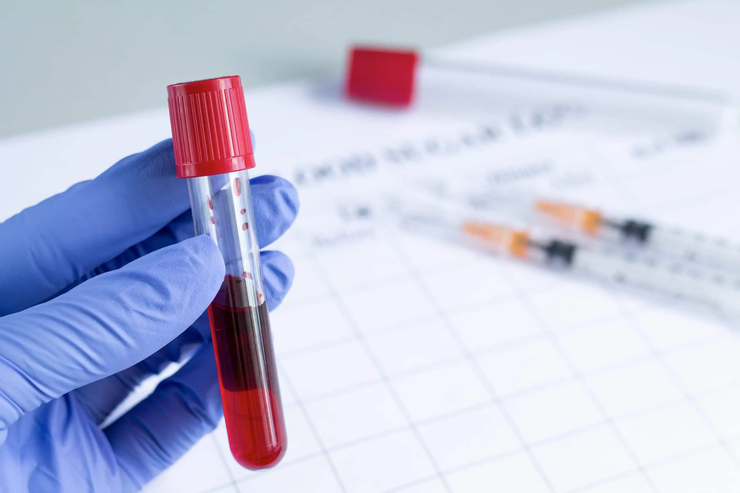 Xét nghiệm máu giúp chẩn đoán bệnh viêm teo niêm mạc dạ dày. (Ảnh minh họa sưu tầm)