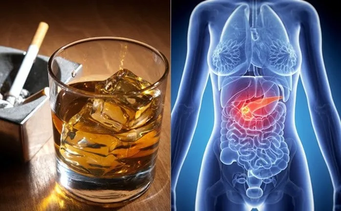 Rượu bia, thuốc lá làm tăng nguy cơ mắc bệnh viêm tụy cấp. (Ảnh minh họa sưu tầm)