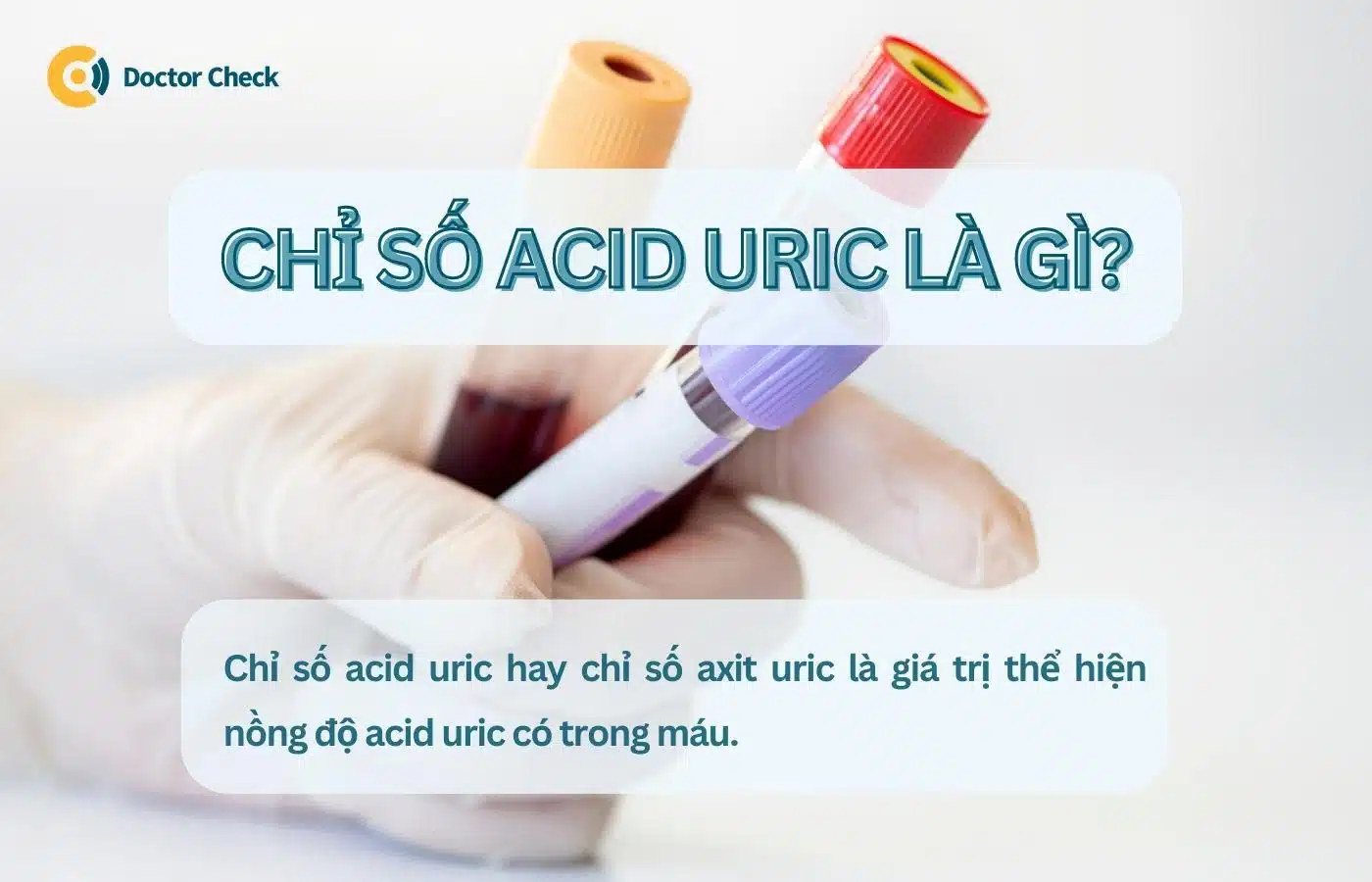 Chỉ số acid uric là gì? Ý nghĩa nồng độ acid uric trong máu