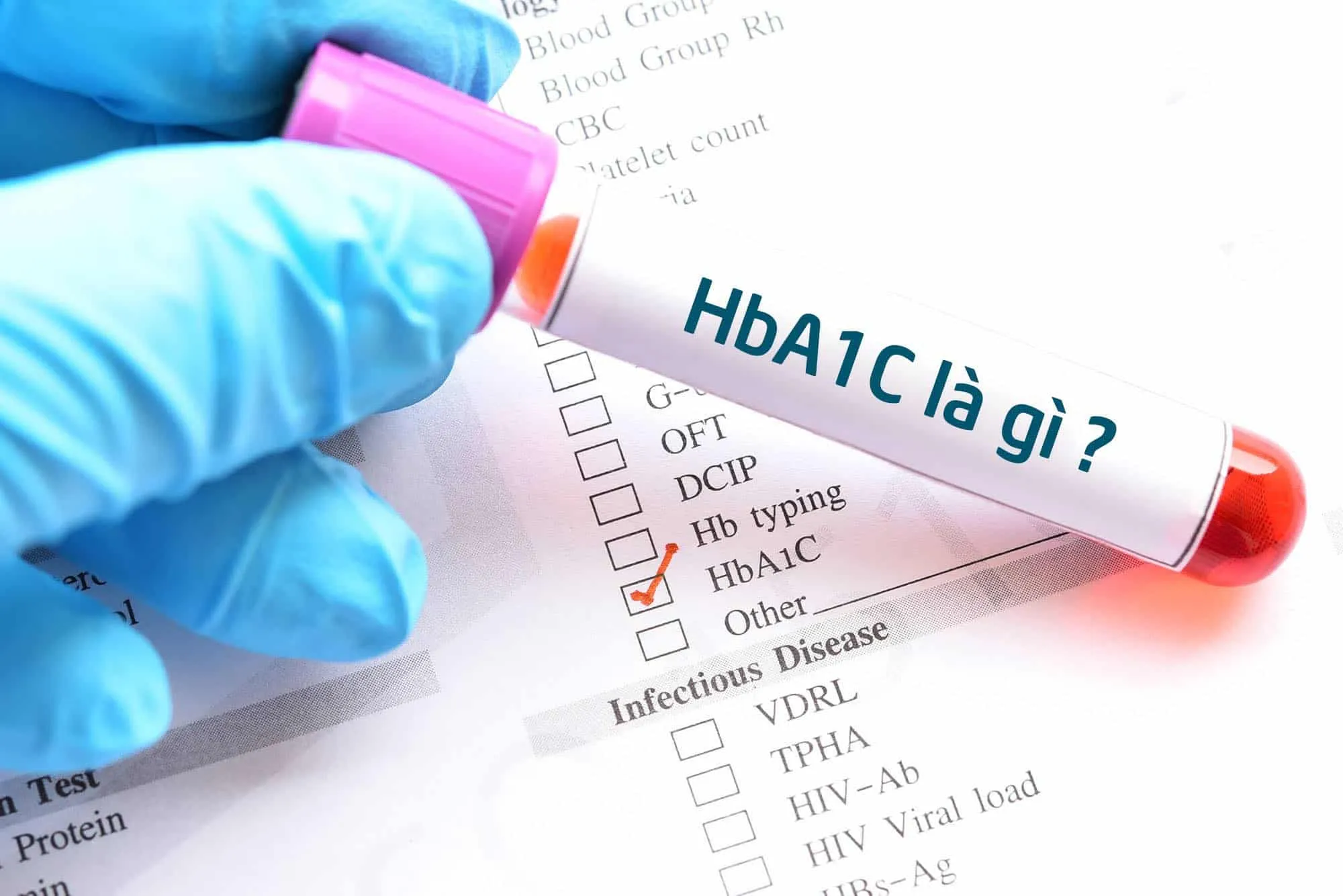 HbA1C là gì?