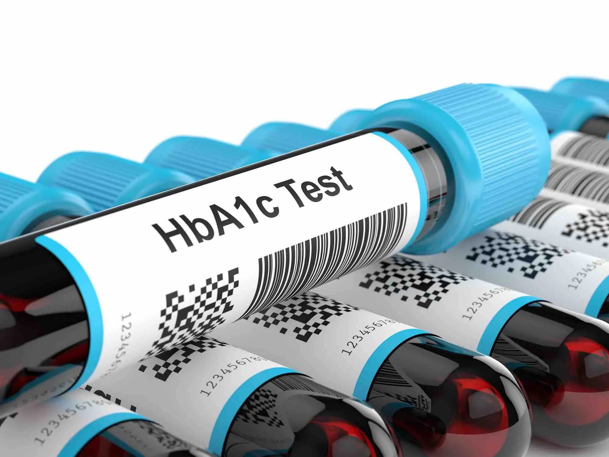 Chẩn đoán bệnh đái tháo đường dựa trên kết quả HbA1C theo ADA 2021