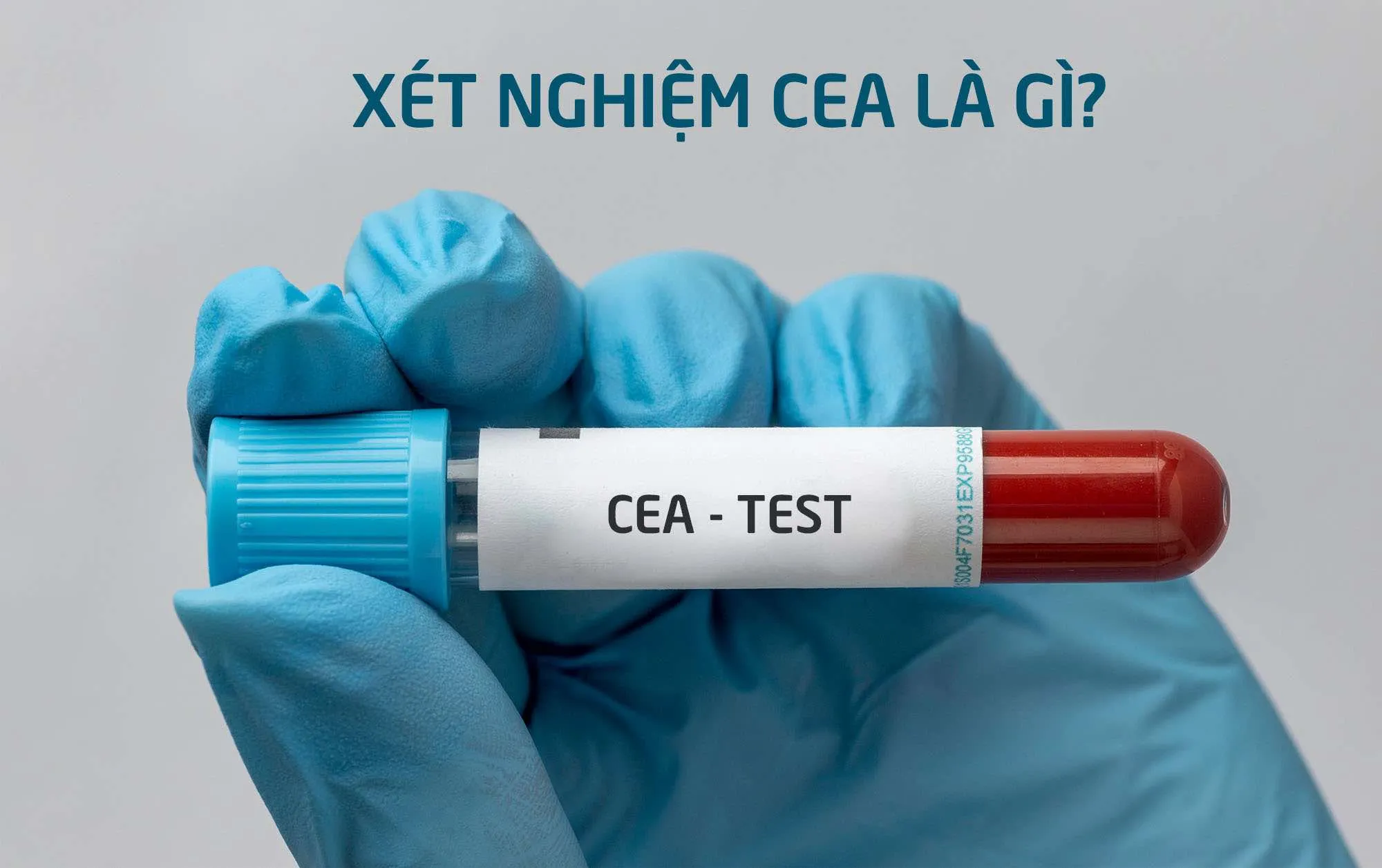 Xét nghiệm CEA là gì? Định lượng nồng độ CEA là gì?
