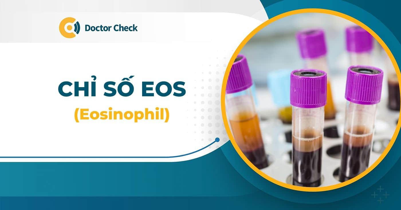 Chỉ số EOS là gì? Chỉ số EOS cao trong máu cảnh báo điều gì?