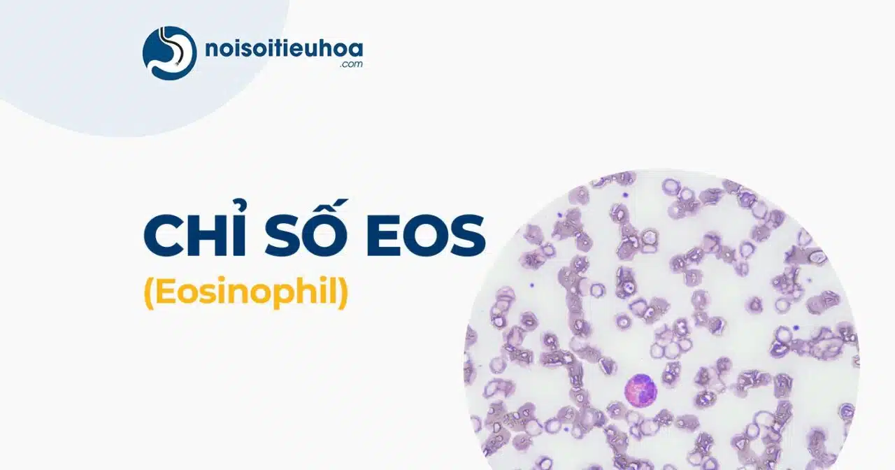 Hình thumbnail chỉ số EOS trong xét nghiệm công thức máu