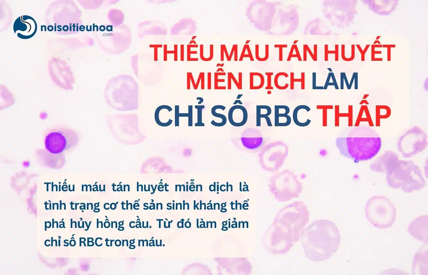 Thiếu máu tán huyết miễn dịch làm chỉ số RBC trong xét nghiệm máu giảm thấp