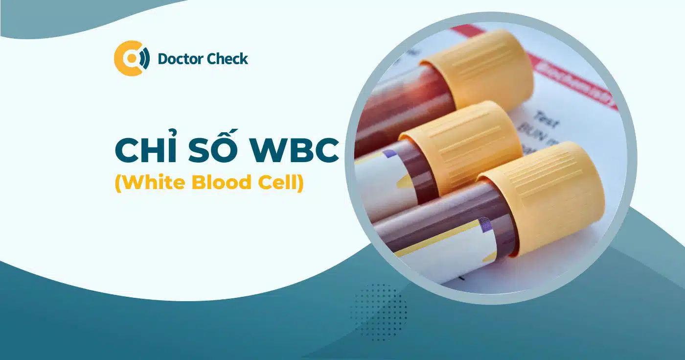 WBC trong xét nghiệm máu là gì? Chỉ số WBC trong máu cao nguy hiểm không?
