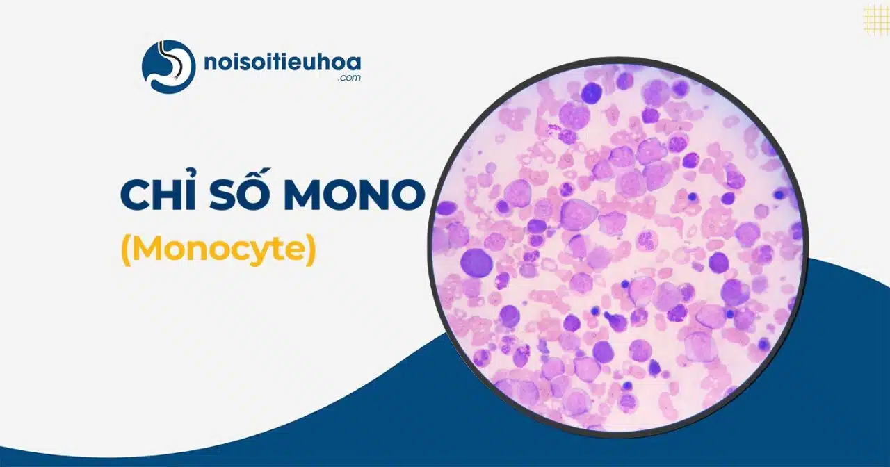Hình thumbnail chỉ số MONO trong xét nghiệm công thức máu