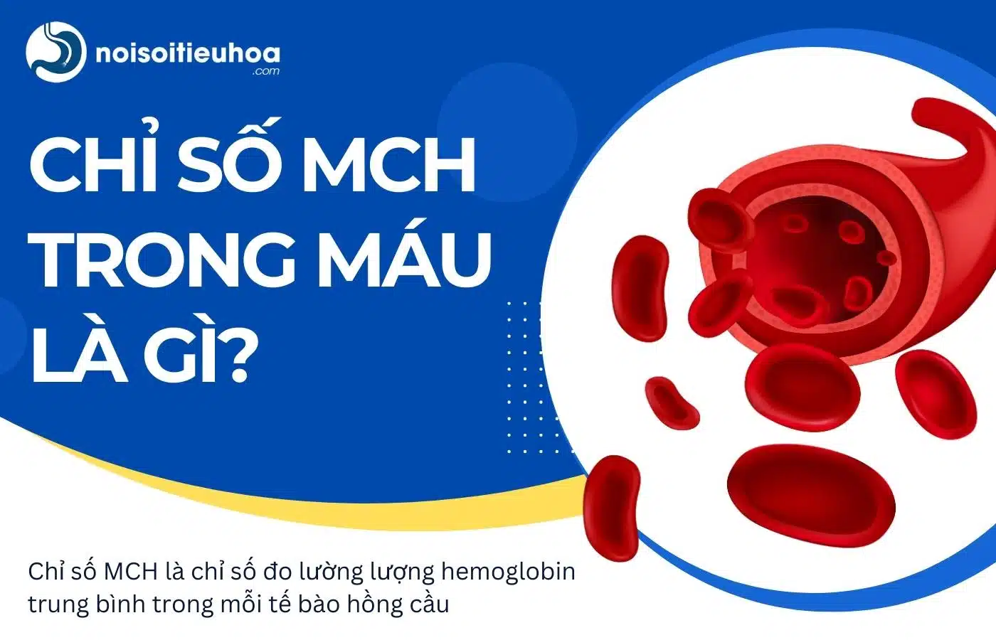 Chỉ số MCH trong xét nghiệm công thức máu là gì?