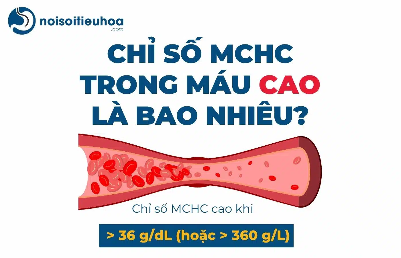 Chỉ số MCHC trong xét nghiệm công thức máu cao là bao nhiêu?
