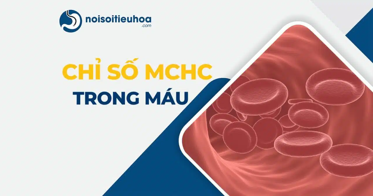 Chỉ số MCHC trong xét nghiệm công thức máu thumbnail