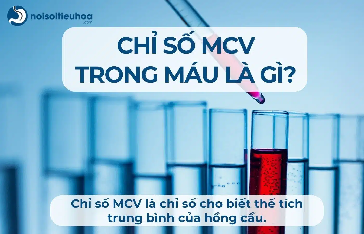 Chỉ số MCV trong xét nghiệm công thức máu là gì?