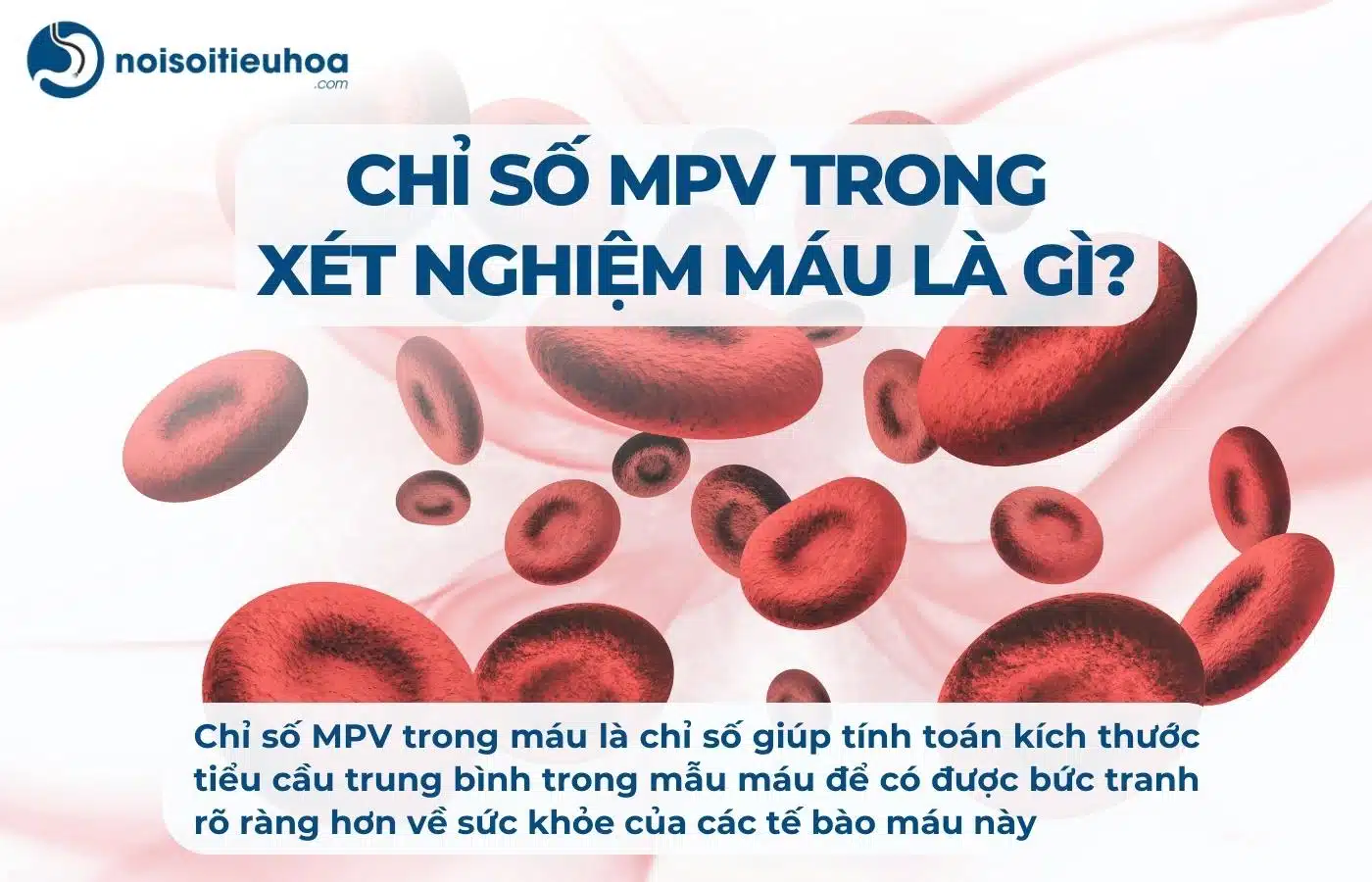 Chỉ số MPV trong xét nghiệm công thức máu là gì?