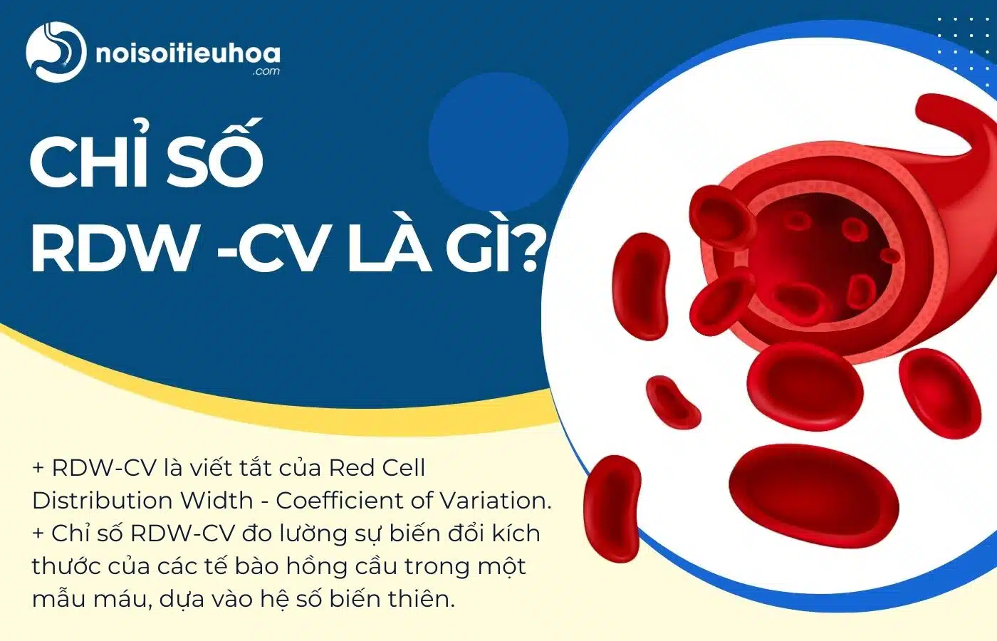 Chỉ số RDW-CV trong xét nghiệm máu là gì?