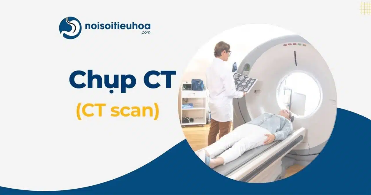 Chụp CT (CT scan) là gì? Chụp CT có nguy hiểm không?