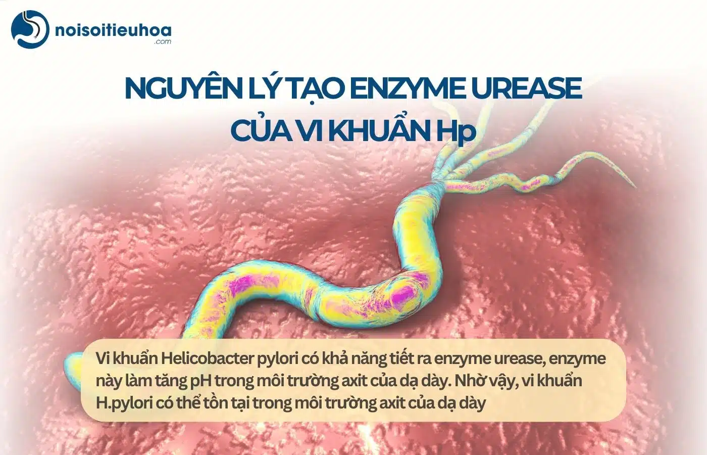 Nguyên lý tạo enzyme urease của vi khuẩn Hp